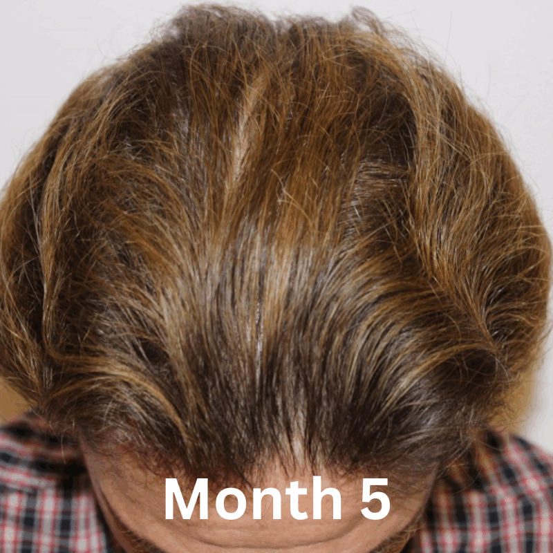 Growth Activation Serum™ - Sale 21 Growth Activation Serum™ - Sale